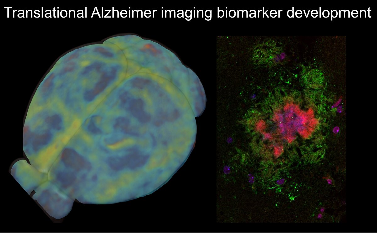 Alzheimer Imaging Biomarker Development