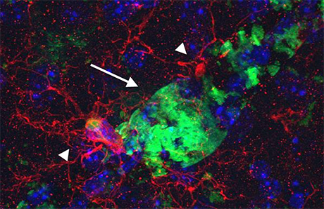 Activation of microglial cells